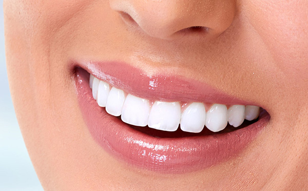 5 Teeth Whitening Facts